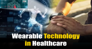 Wearable Technology in Healthcare: A Game Changer Wearable Technology in Healthcare