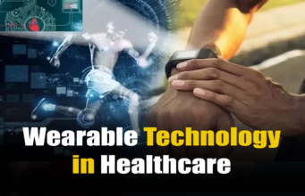 Wearable Technology in Healthcare: A Game Changer Wearable Technology in Healthcare